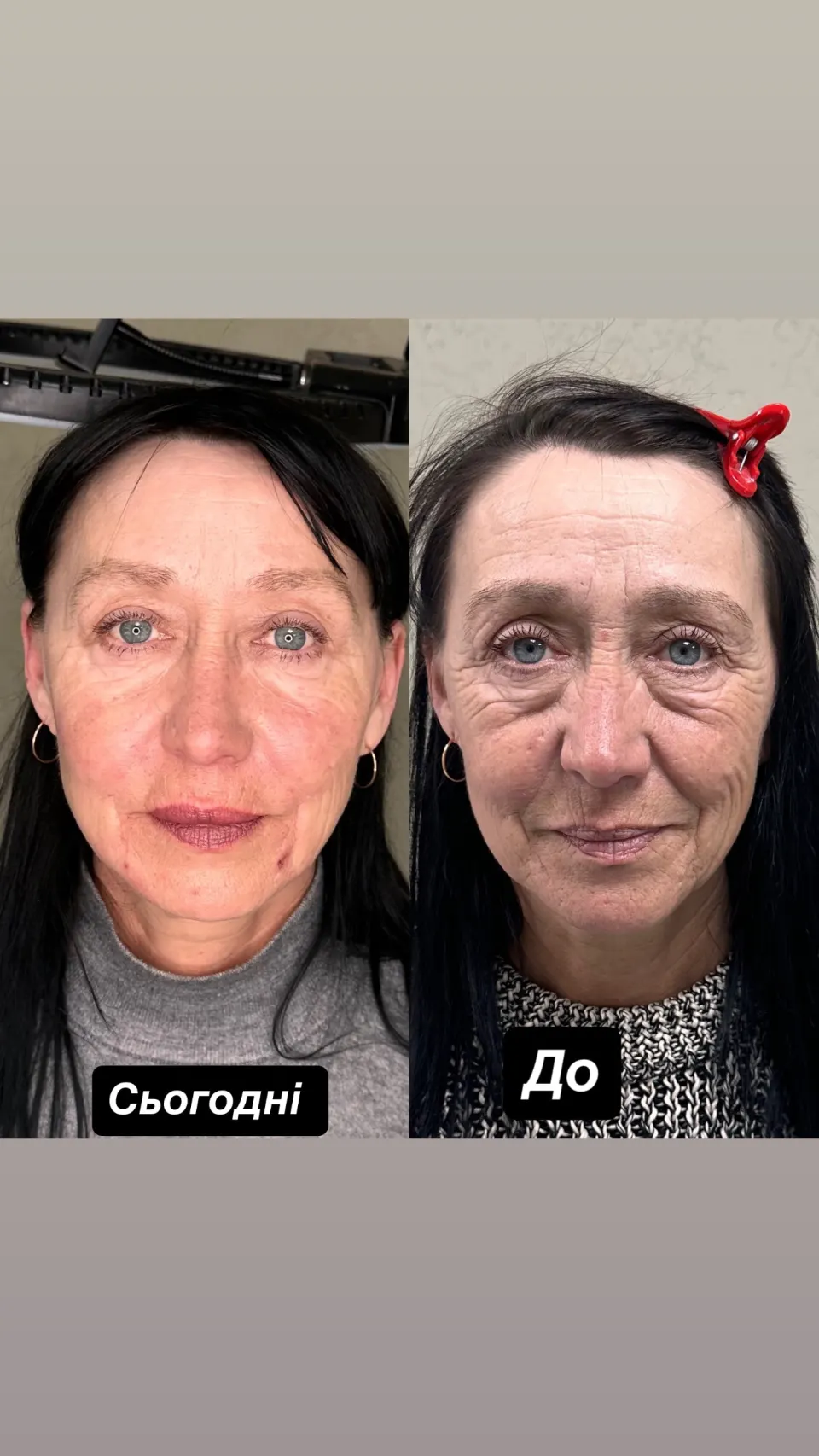 Робота майстра — результат до і після