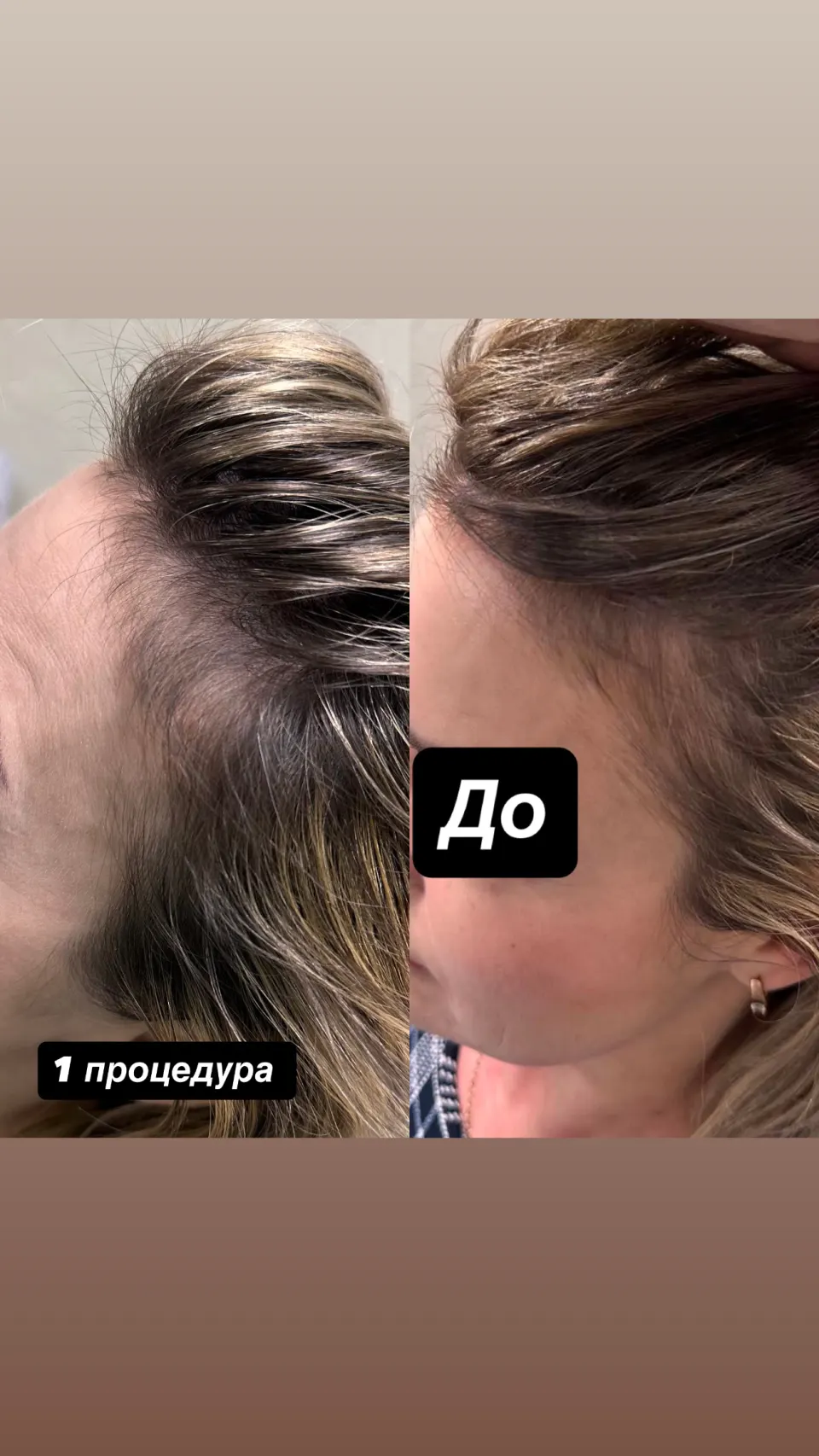 Робота майстра — результат до і після