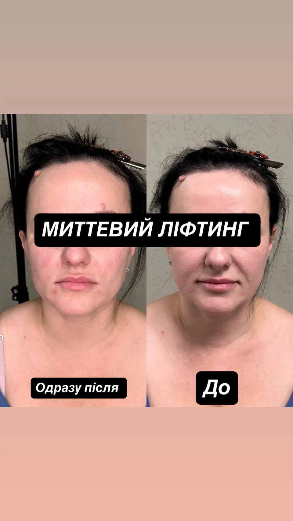 Робота майстра — результат до і після