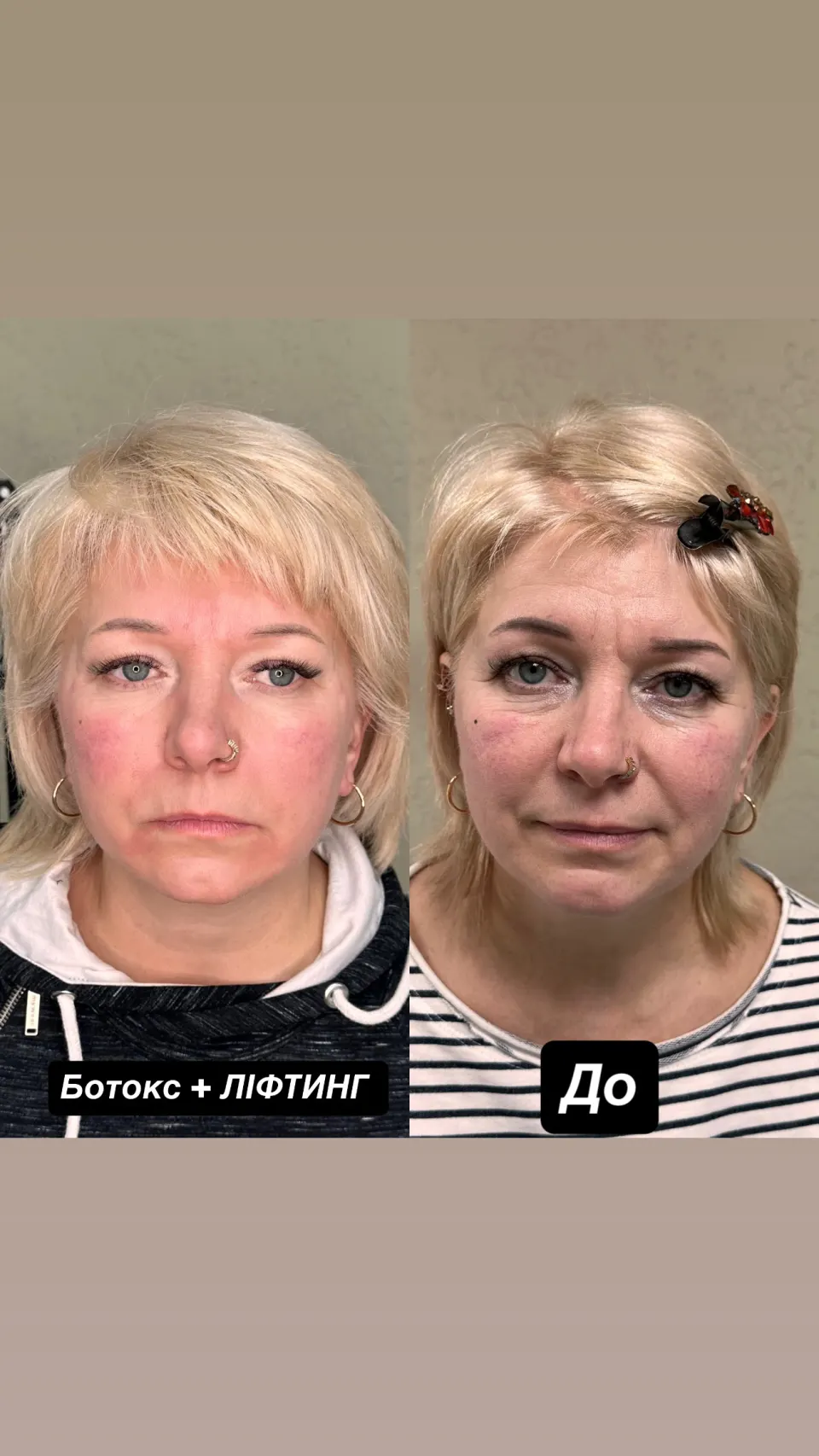 Робота майстра — результат до і після