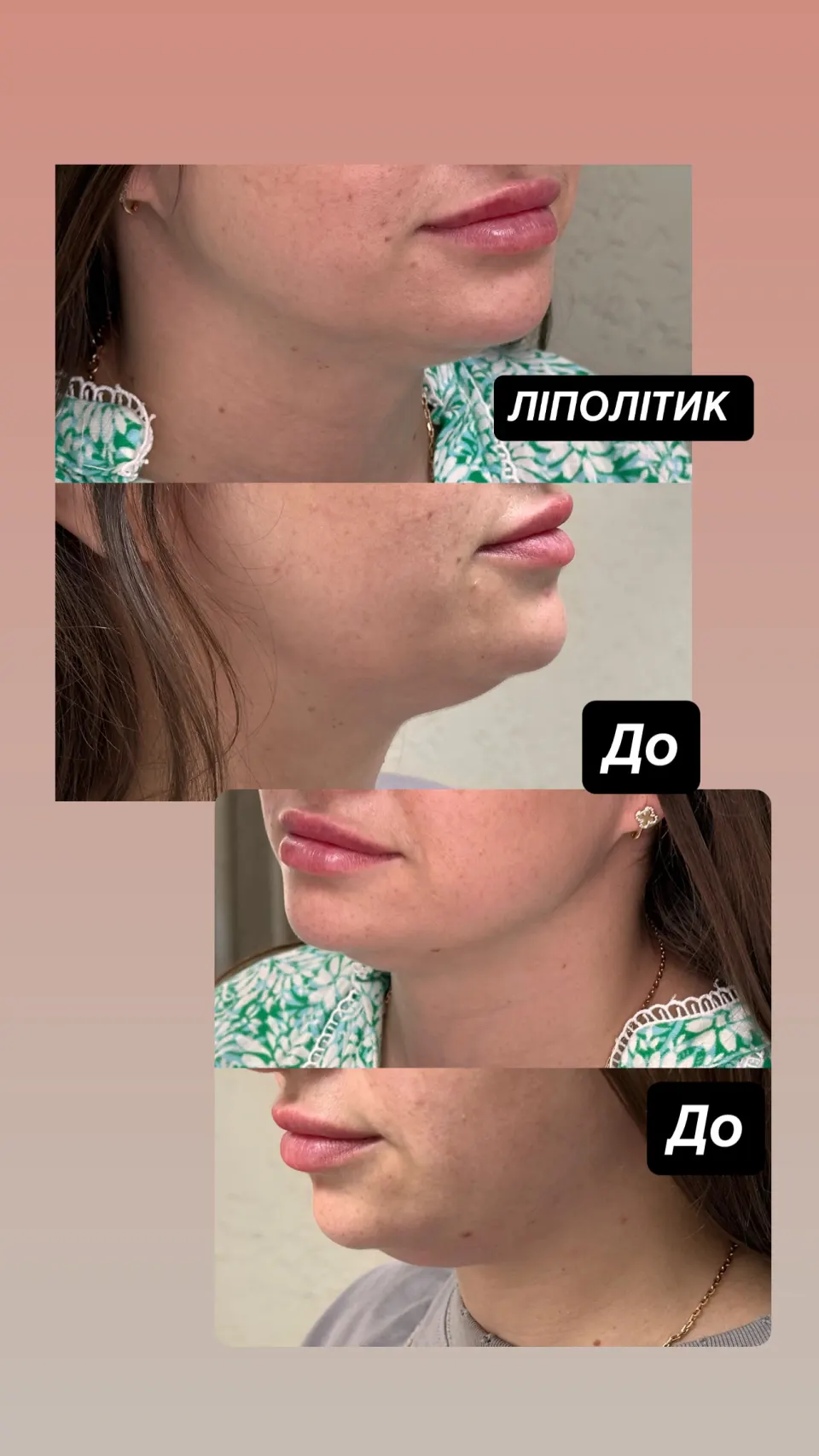 Робота майстра — результат до і після
