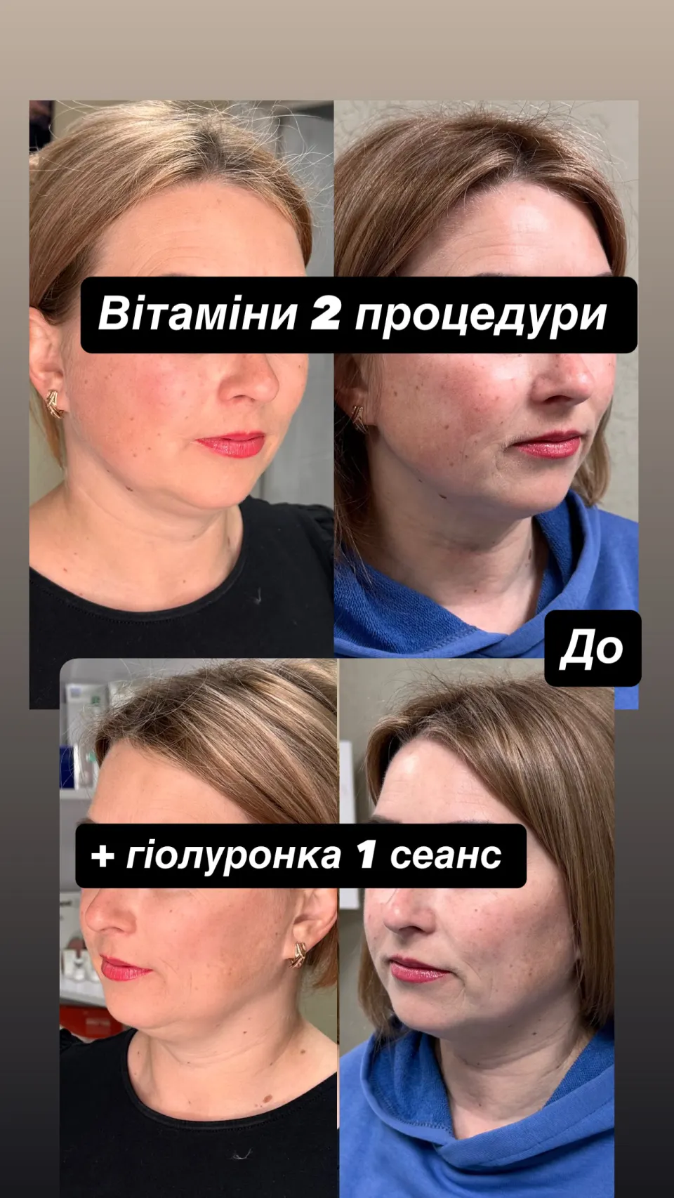Робота майстра — результат до і після