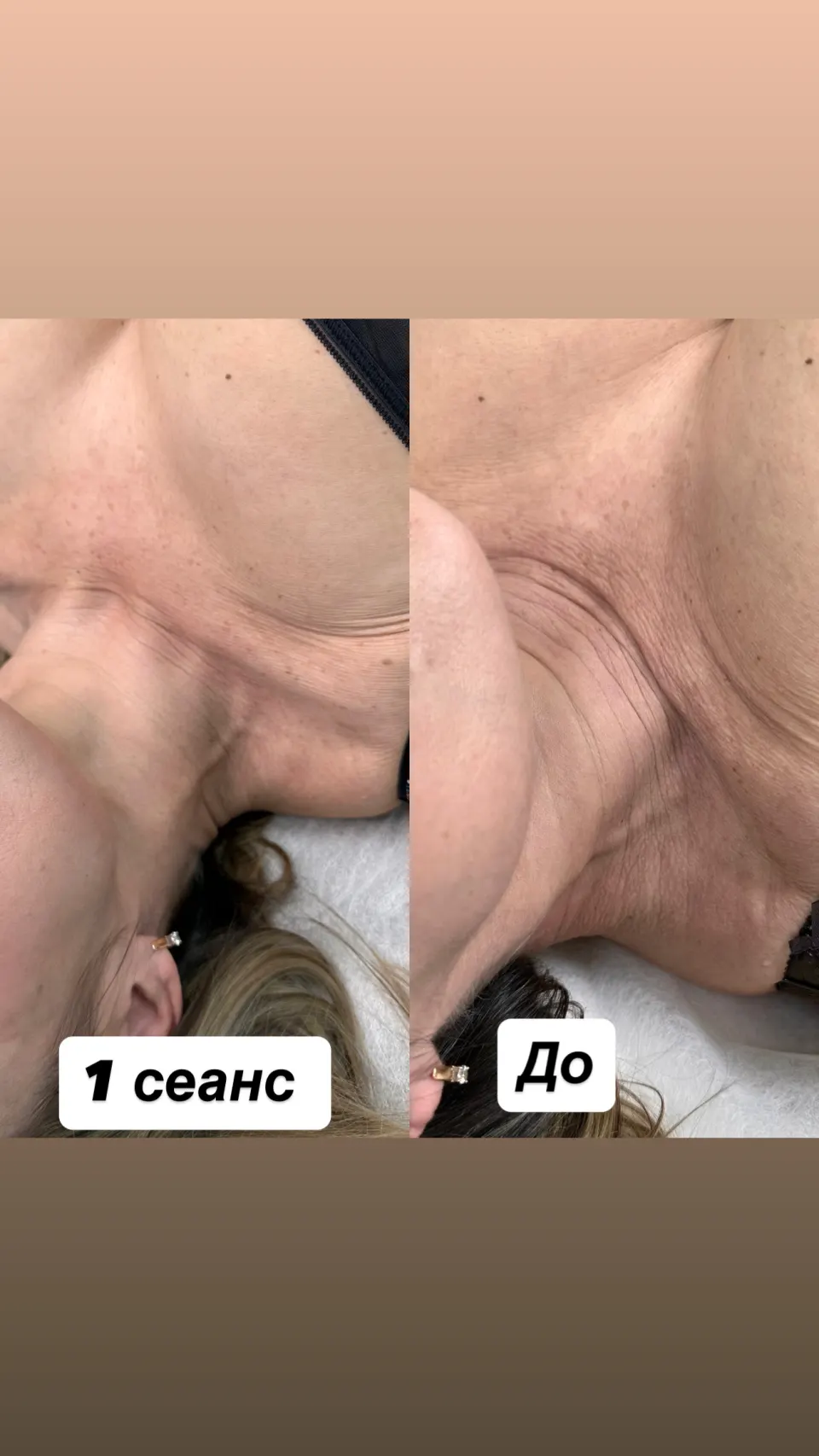 Робота майстра — результат до і після